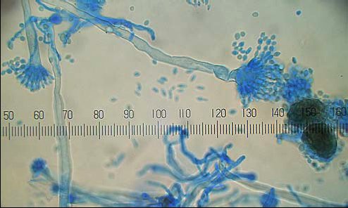 (B) Konidiophore (a) und Kleistothezien (b) von Eurotium sp.  © www.myko-lab.de